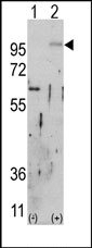 AP14341PU-N - CD332 / FGFR-2