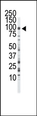 AP14342PU-N - CD333 / FGFR3