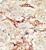 AP14342PU-N - CD333 / FGFR3