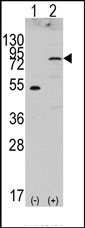 AP14344PU-N - CD334 / FGFR4