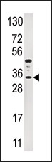 AP14345PU-N - IGFBP3