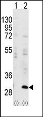 AP14347PU-N - IGFBP3