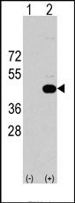 AP14359PU-N - HS2ST1 / 2OST