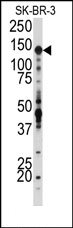 AP14361PU-N - CD221 / IGF1R