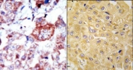 AP14363PU-N - Integrin-linked protein kinase