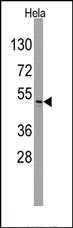 AP14366PU-N - Integrin-linked protein kinase