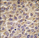 AP14366PU-N - Integrin-linked protein kinase