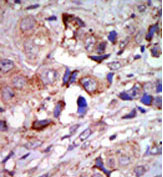 AP13892PU-N - MAP3K12