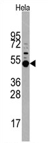 AP13894PU-N - MAPKAP Kinase-5