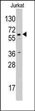 AP14221PU-N - Aromatase