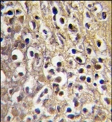 AP14221PU-N - Aromatase