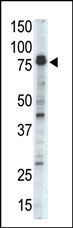 AP13897PU-N - Doublecortin-like kinase 1