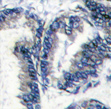AP13898PU-N - Doublecortin-like kinase 1