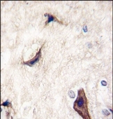 AP14236PU-N - RASGRF1