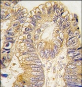 AP14238PU-N - CLIC5