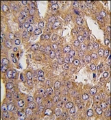 AP14242PU-N - NASP