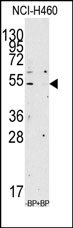 AP14249PU-N - Apolipoprotein A IV / ApoA4