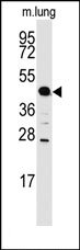 AP14250PU-N - ACPP / Prostatic acid phosphatase