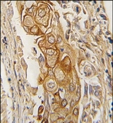 AP14250PU-N - ACPP / Prostatic acid phosphatase