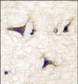 AP14255PU-N - DAAM2