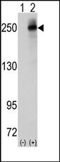 AP14267PU-N - CD246 / Anaplastic lymphoma kinase