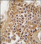 AP14267PU-N - CD246 / Anaplastic lymphoma kinase