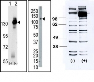 TA300025 - CD115