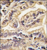 TA300025 - CD115