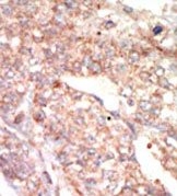 AP14272PU-N - EPHA1