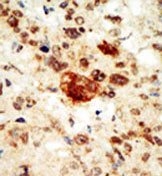 AP14273PU-N - EPHA1