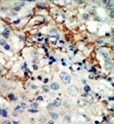 AP14276PU-N - EPHA3