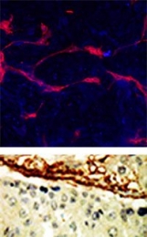 AP14278PU-N - EPHA4