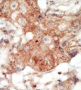 AP14279PU-N - EPHA4