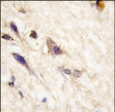 AP14281PU-N - EPHA5