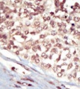 AP14282PU-N - EPHA5