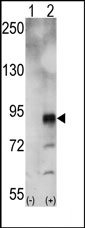 AP14283PU-N - EPHA5