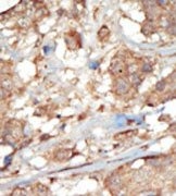 AP14285PU-N - EphA6