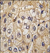 AP14289PU-N - EPHA7