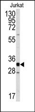 AP14142PU-N - CDK2