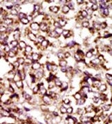 AP14142PU-N - CDK2