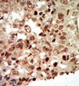 AP13902PU-N - MAP kinase p38 beta / MAPK11