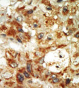AP13903PU-N - MAPK12