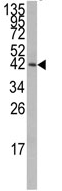 AP13908PU-N - MAP kinase p38 alpha / MAPK14