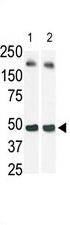 AP13921PU-N - Sphingosine kinase 1 (SPHK1)
