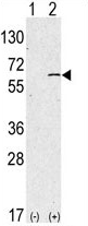 AP13921PU-N - Sphingosine kinase 1 (SPHK1)
