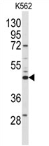 AP13923PU-N - Sphingosine kinase 1 (SPHK1)
