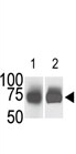 AP13924PU-N - Sphingosine kinase 2 / SPK2