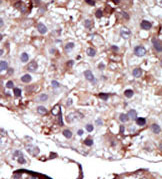 AP13924PU-N - Sphingosine kinase 2 / SPK2