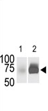 AP13925PU-N - Sphingosine kinase 2 / SPK2