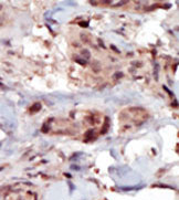 AP13925PU-N - Sphingosine kinase 2 / SPK2
